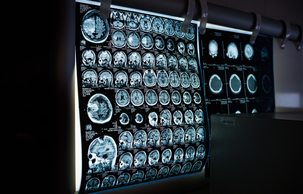MRI